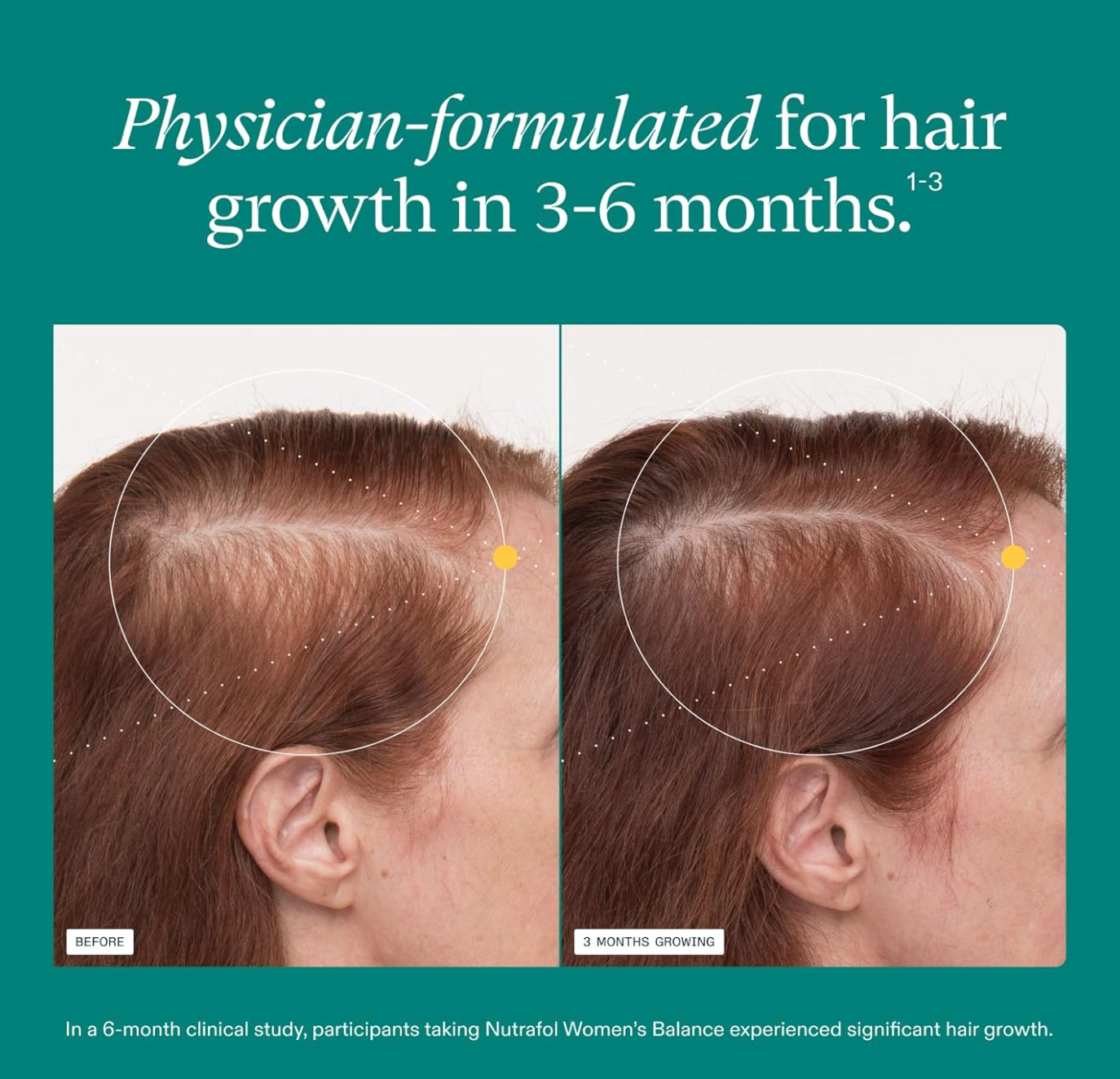 Nutrafol Women's Balance Hair Growth Supplements